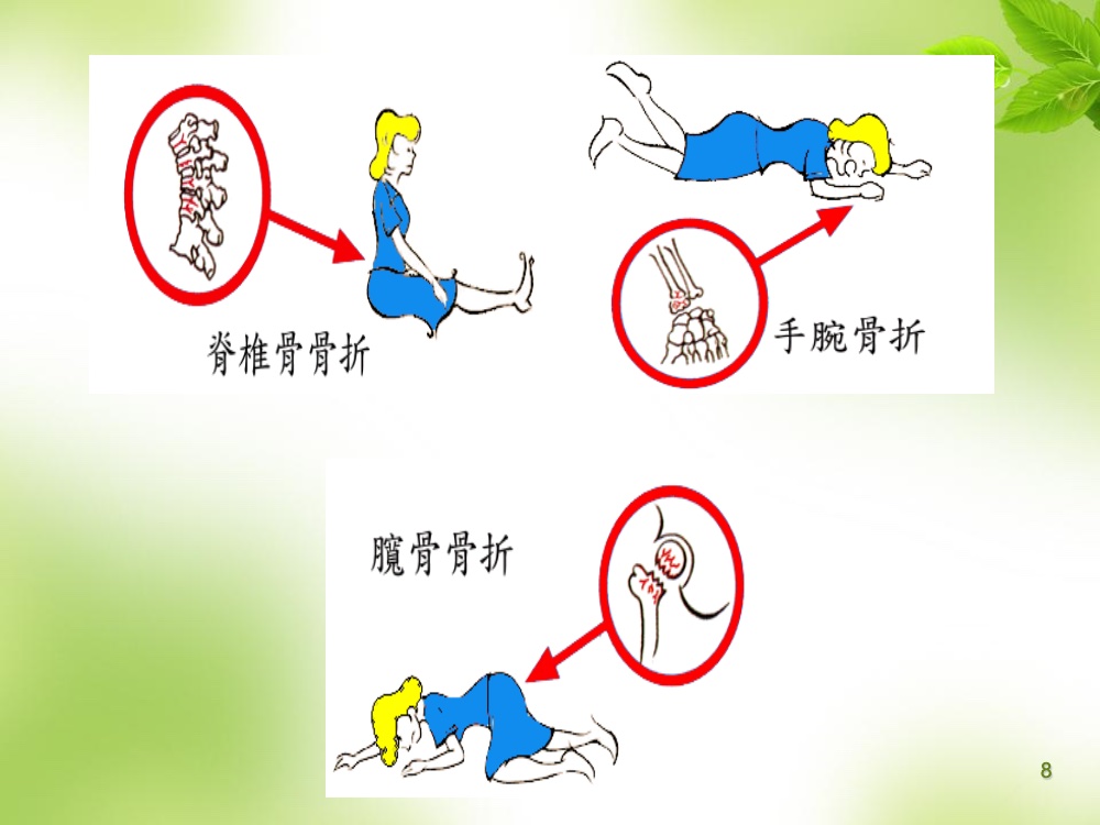 骨质疏松的科普ppt课件8