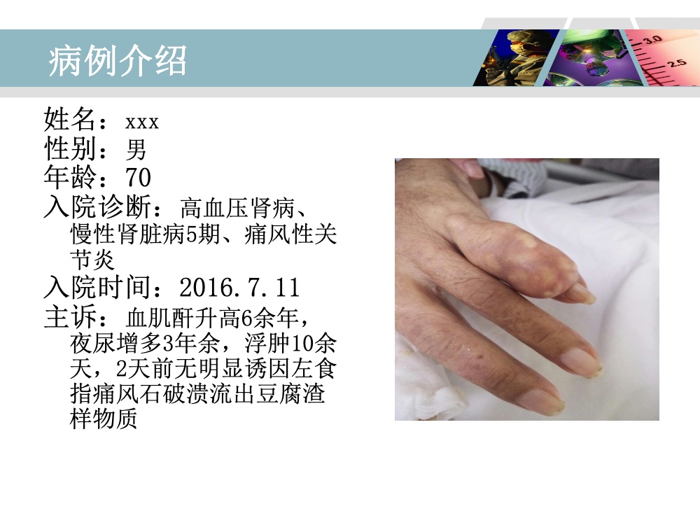 高血压肾病合并痛风性关节炎的个案护理ppt课件5