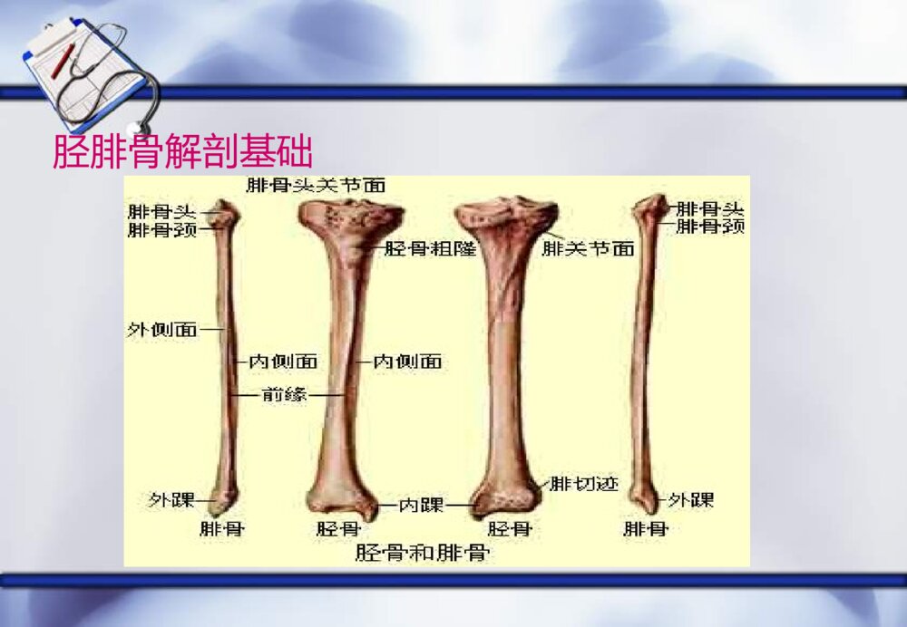 骨筋膜室综合症护理查房ppt课件9