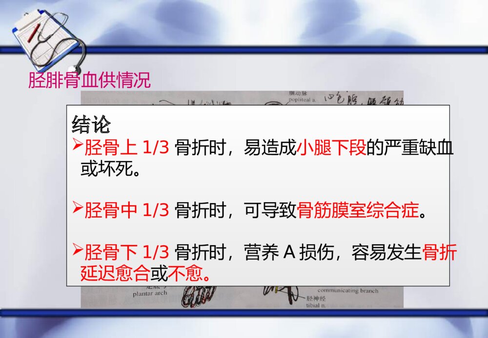骨筋膜室综合症护理查房ppt课件10