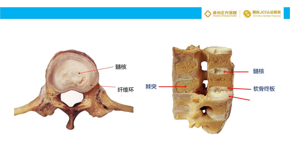腰椎间盘突出症诊断与治疗PPT课件6