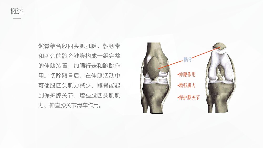 髌骨骨折的护理业务学习PPT课件5
