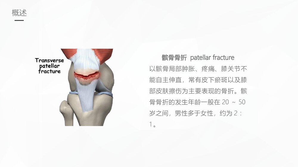 髌骨骨折的护理业务学习PPT课件6