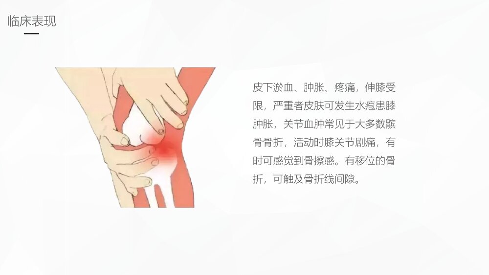 髌骨骨折的护理业务学习PPT课件9