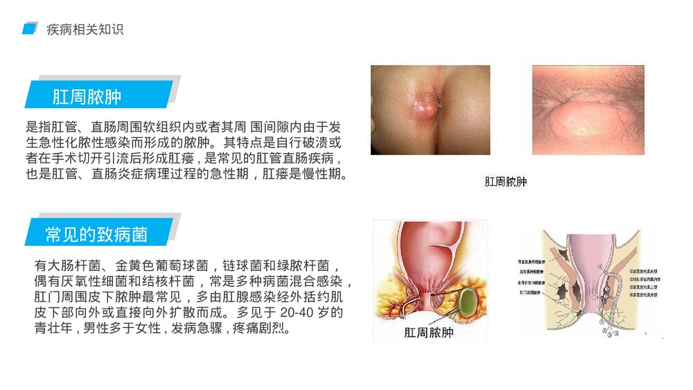 简约商务风肛肠科护理查房PPT课件4