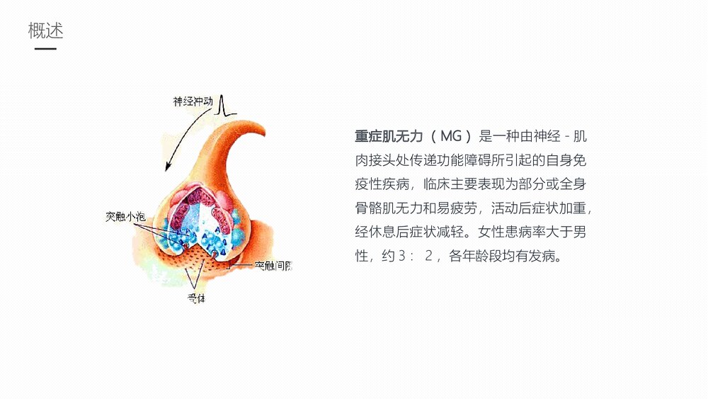 重症肌无力的护理业务学习PPT课件课件4