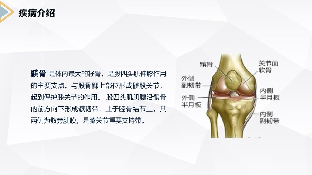 髌骨骨折的护理查房PPT课件4