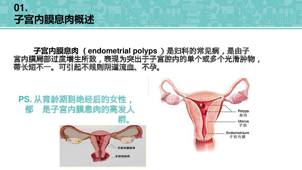 (妇科)子宫内膜息肉检查治疗护理PPT课件3