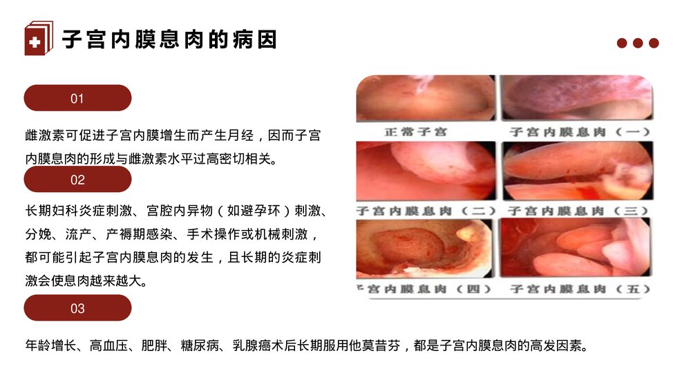 子宫内膜息肉的治疗护理PPT课件5