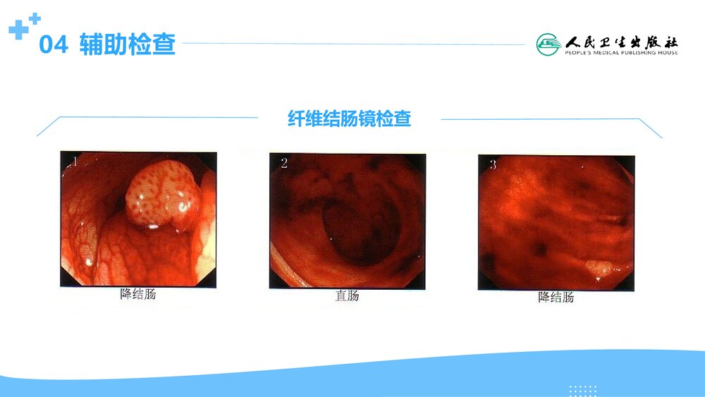 消化道出血伴急性肾损伤PPT课件6