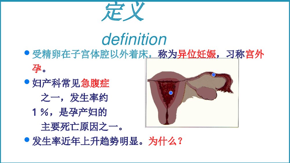 异位妊娠教学课件PPT3