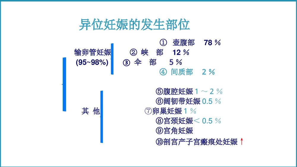 异位妊娠教学课件PPT4