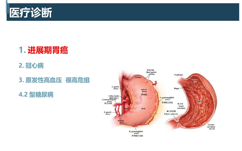肿瘤科胃癌PBL护理教学查房8