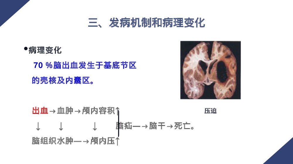 脑出血病人的护理PPT课件5
