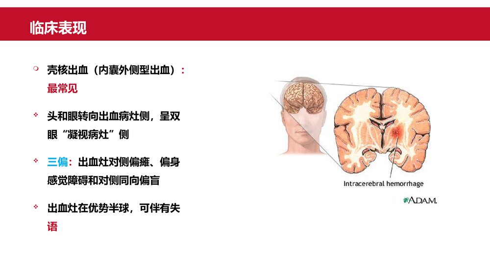 脑出血患者治疗护理保健指导PPT课件8