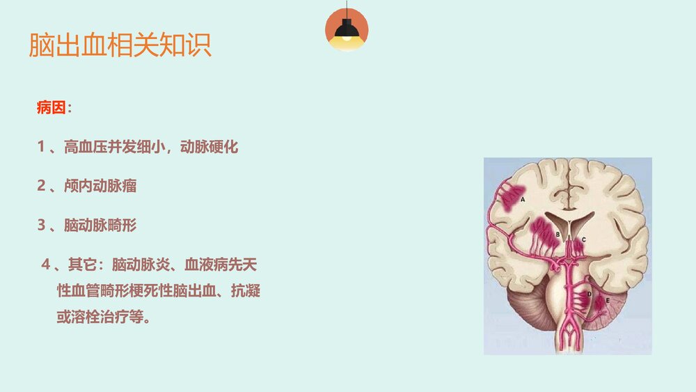脑出血患者的护理查房PPT课件6