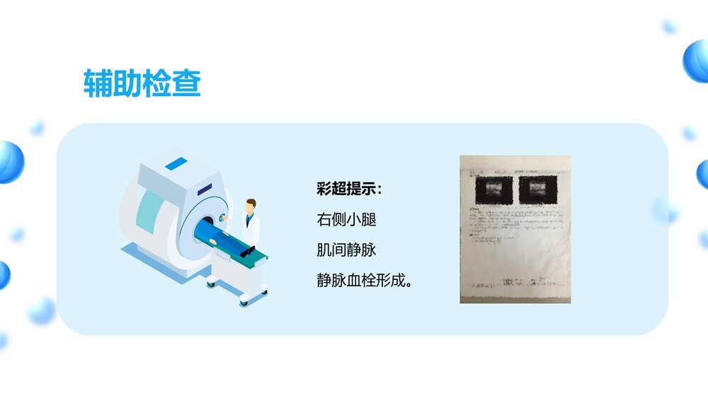 医学医疗下肢静脉血栓的护理查房ppt7