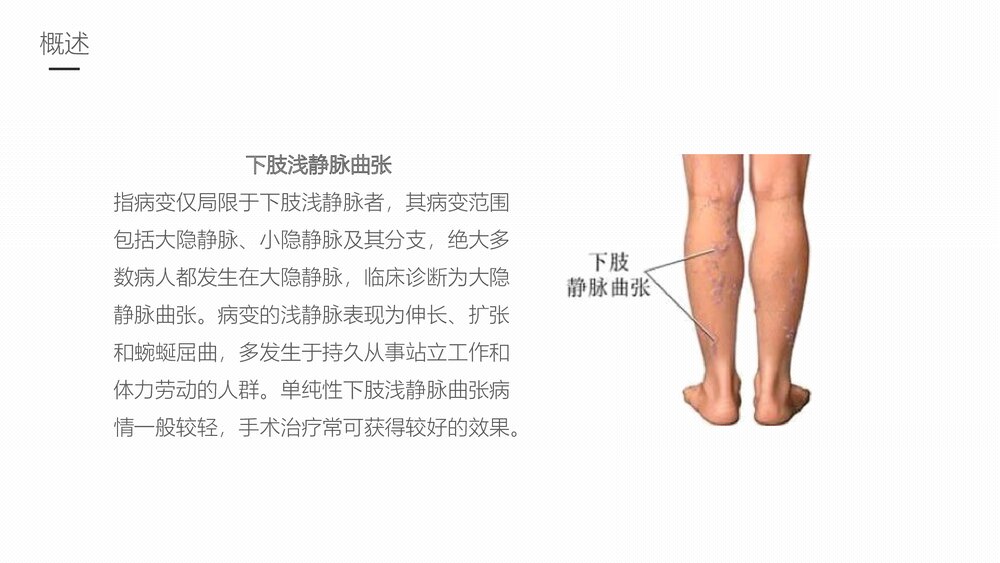 下肢静脉曲张的护理业务学习课件4
