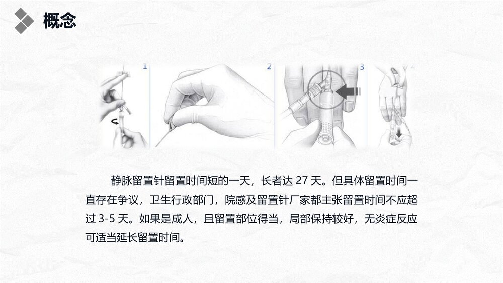 浅静脉留置针应用与维护PPT课件5