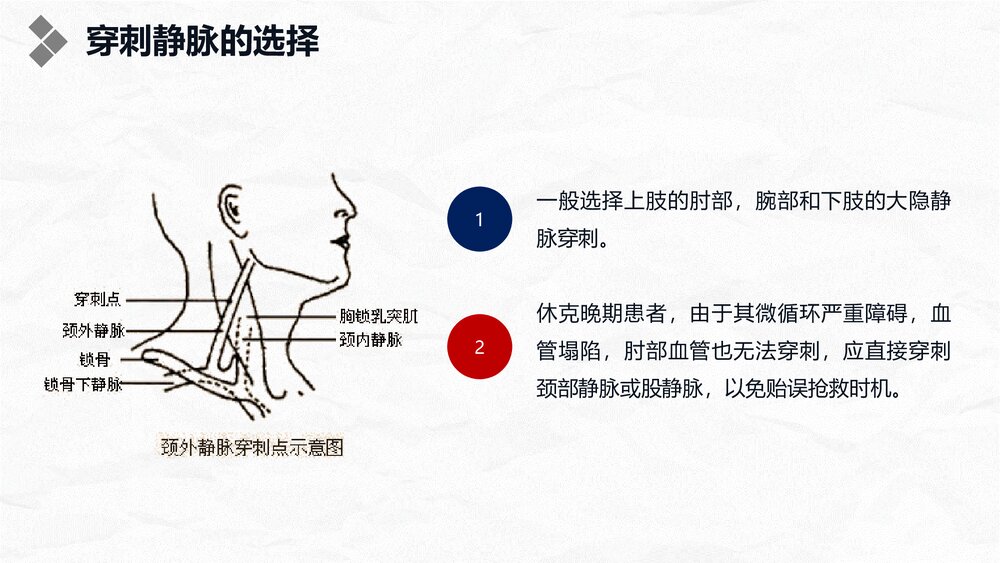 浅静脉留置针应用与维护PPT课件10