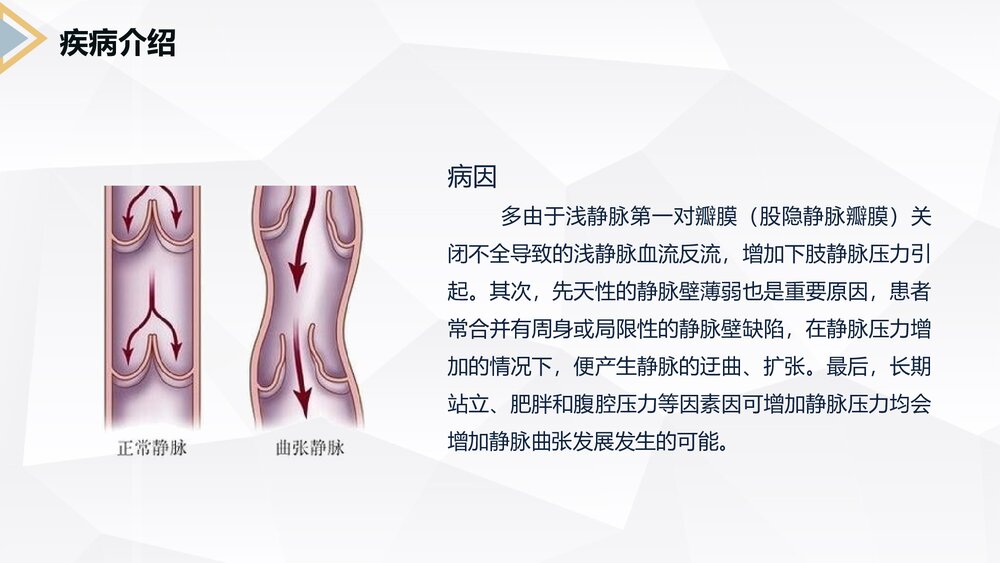 下肢静脉曲张的护理查房PPT课件6