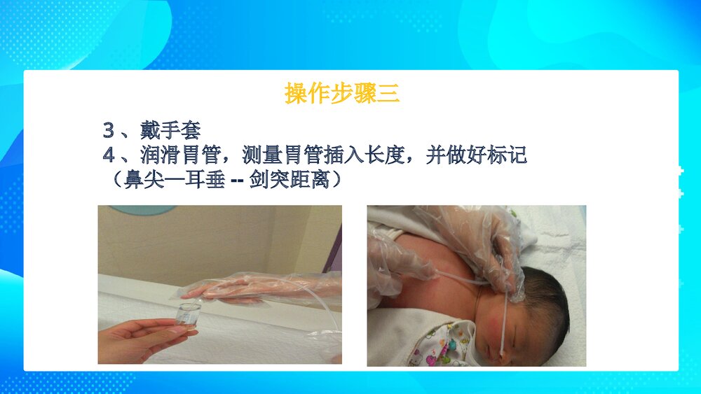 新生儿洗胃操作方法PPT课件8