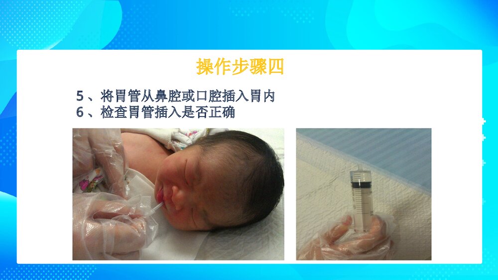 新生儿洗胃操作方法PPT课件9