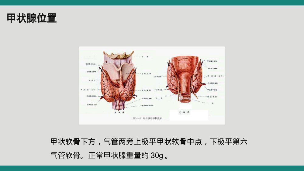 甲状腺术后病人护理查房PPT课件3