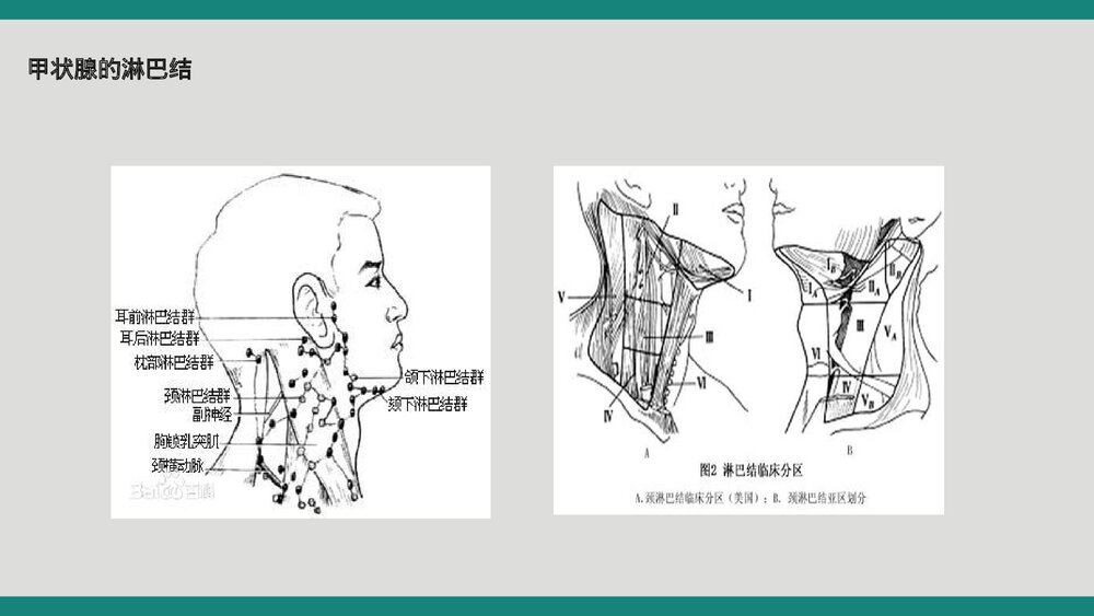 甲状腺术后病人护理查房PPT课件6