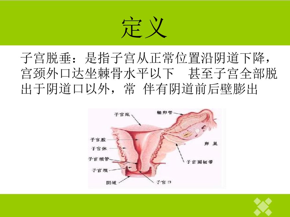 子宫脱垂患者的护理PPT课件4