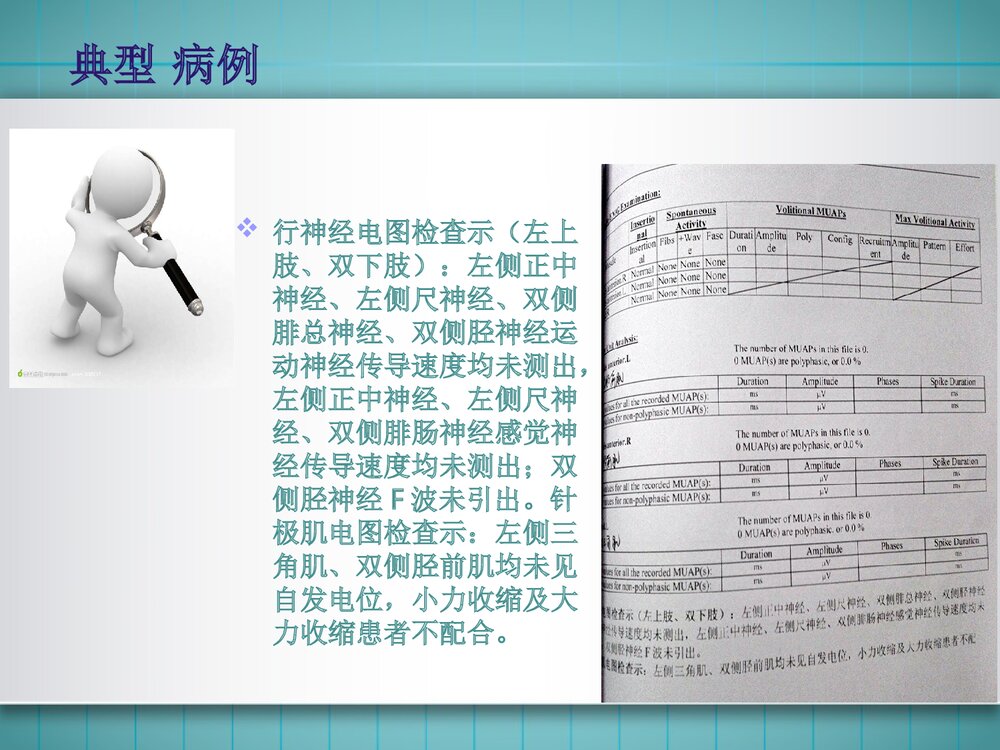 吉兰巴雷综合征PPT课件 神经内科吉兰巴雷综合征临床表现诊断治疗6