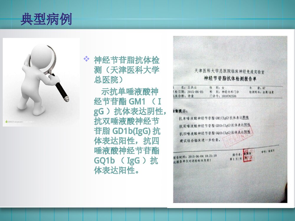 吉兰巴雷综合征PPT课件 神经内科吉兰巴雷综合征临床表现诊断治疗7