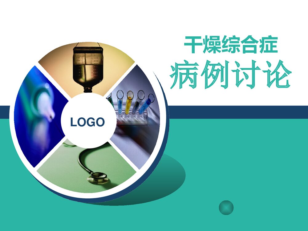 干燥综合症病例讨论PPT课件1