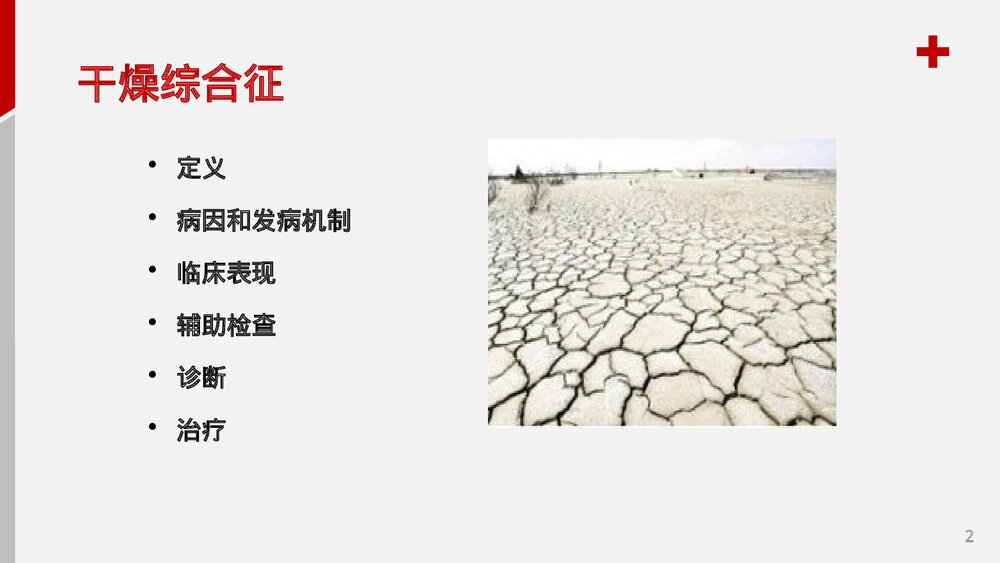 干燥综合症护理查房PPT课件2
