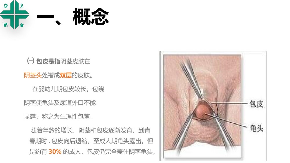 包皮包茎课件PPT课件3