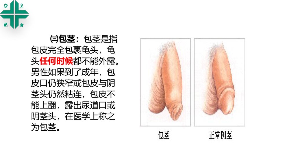 包皮包茎课件PPT课件7