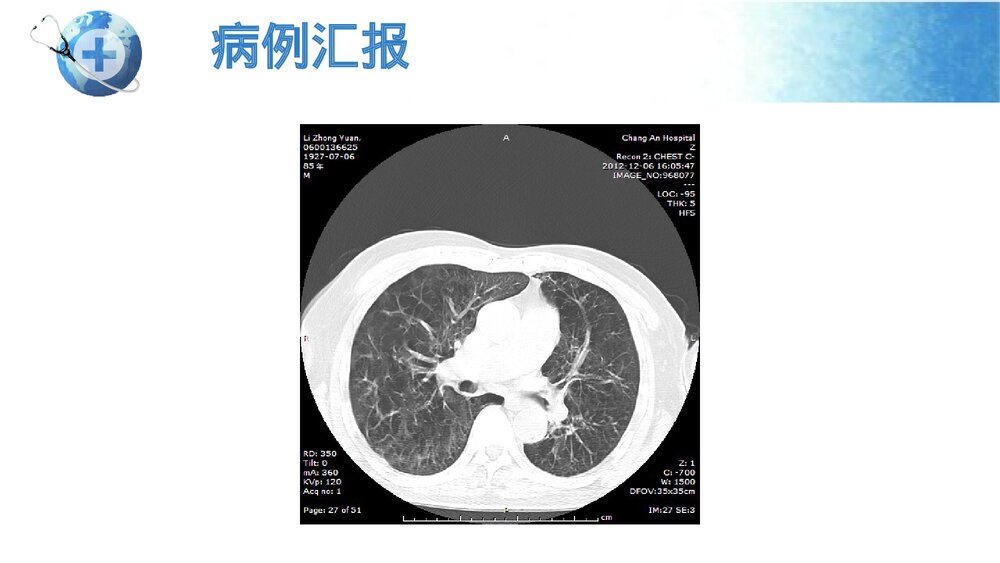 呼吸衰竭患者的护理查房PPT课件6