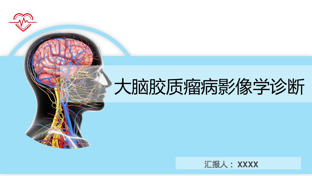 大脑胶质瘤病影像学诊断PPT课件1