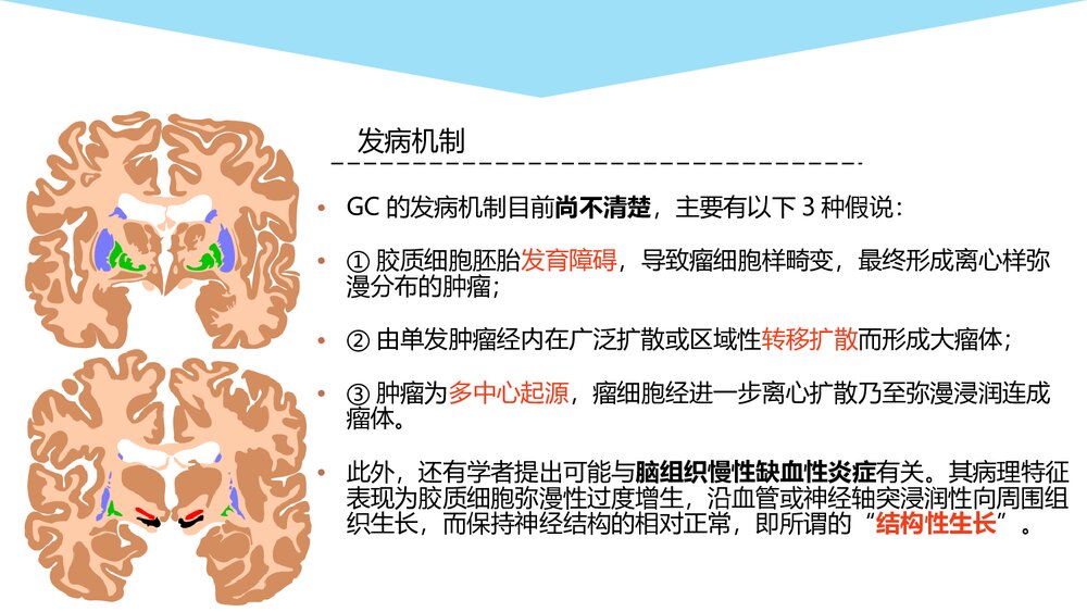 大脑胶质瘤病影像学诊断PPT课件5