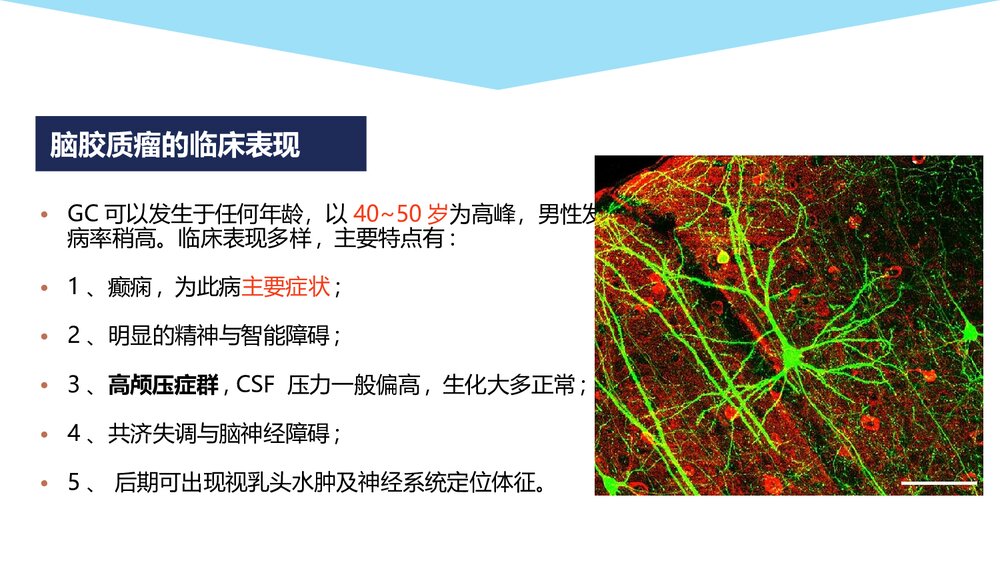 大脑胶质瘤病影像学诊断PPT课件6