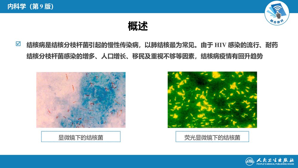 第七章《肺结核》呼吸系统疾病PPT课件4