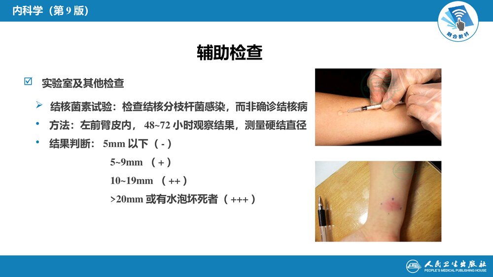 第七章《肺结核》呼吸系统疾病PPT课件10