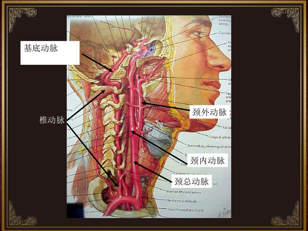 脑血管解剖及脑梗塞定位诊断PPT课件9