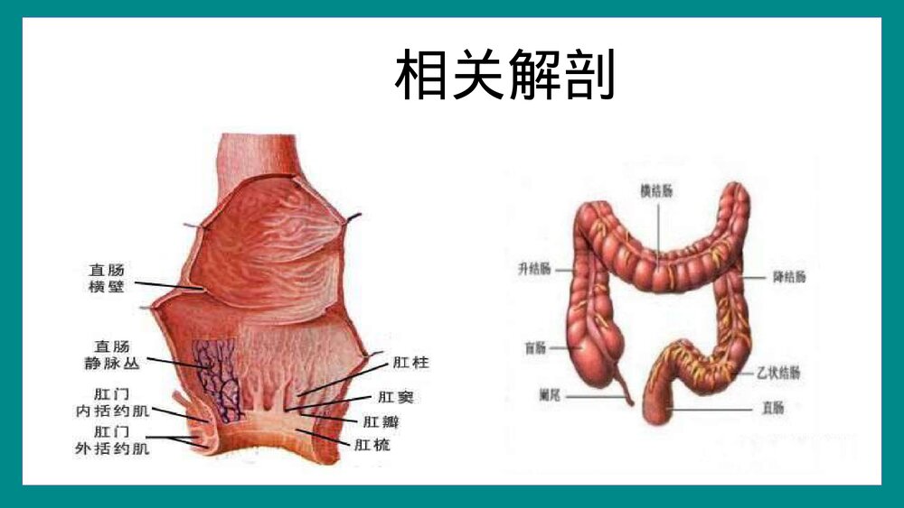 直肠癌根治术手术配合PPT课件9