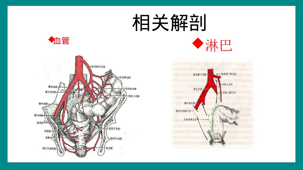 直肠癌根治术手术配合PPT课件10