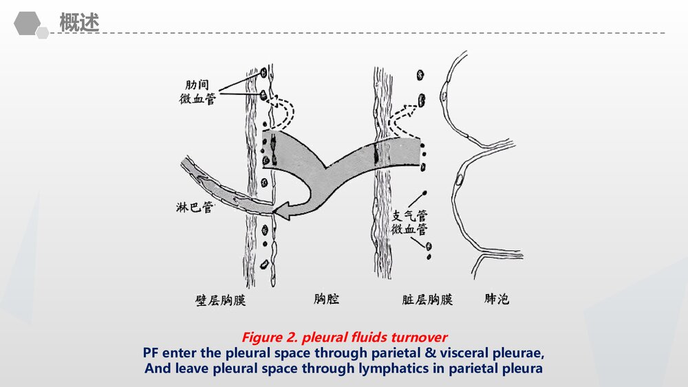 胸腔积液教案课件PPT (共45页·内容文字可编辑修改)6