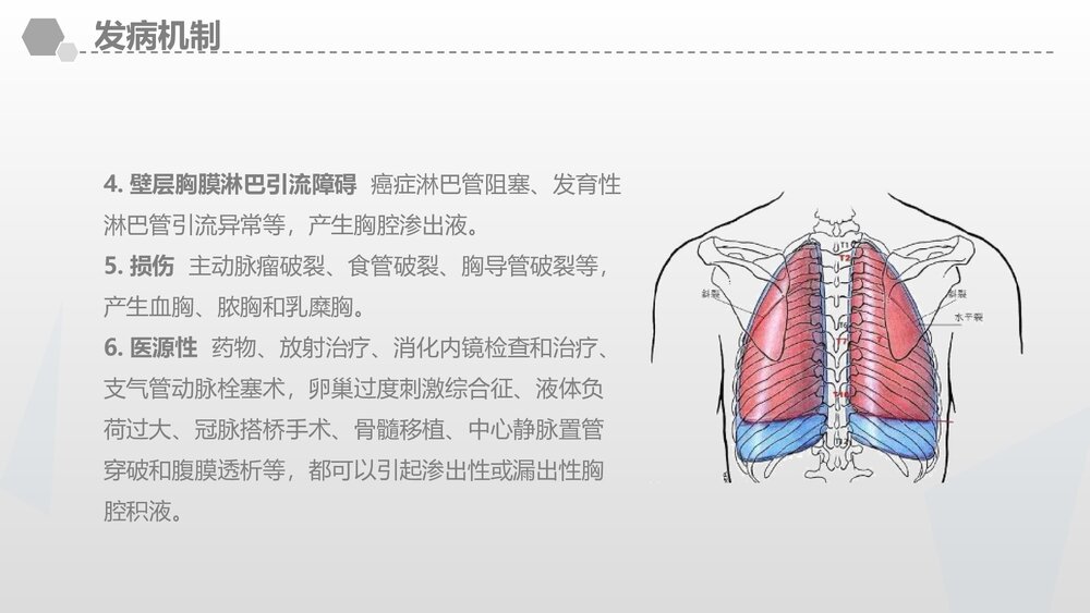 胸腔积液教案课件PPT (共45页·内容文字可编辑修改)8