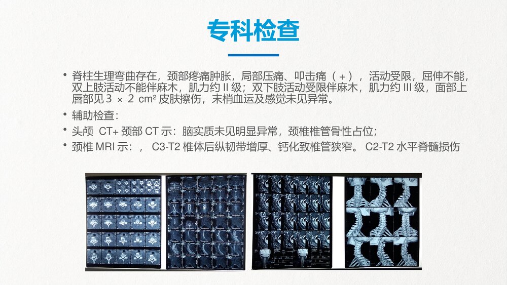 脊髓损伤的护理查房知识培训PPT(共43页·内容文字可编辑修改)6