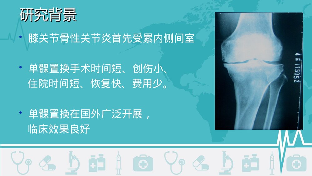 膝关节单髁置换术治疗内侧间室骨性关节炎PPT课件2