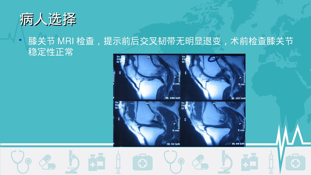 膝关节单髁置换术治疗内侧间室骨性关节炎PPT课件6